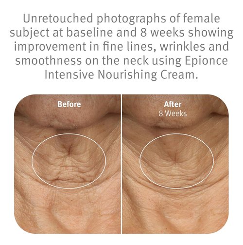 Epionce Intensive Nourishing Cream - Rich Anti-Aging Moisturizer for Face, Neck & Décolletage | Hydrates with Ceramides, Glycerin & Squalene | Fights Fine Lines & Dark Spots