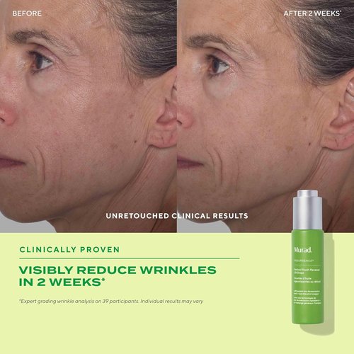 Murad Retinol Youth Renewal Oil Drops - Anti-Aging Facial Oil with Omega-Rich Hydration - 1.0 oz