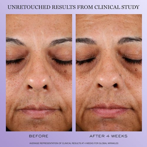 Lancôme Rénergie H.P.N. 300-Peptide Anti-Aging Face Cream with Hyaluronic Acid, Niacinamide & 300 Peptides - Visibly Reduces Wrinkles, Dark Spots & Sagging Skin
