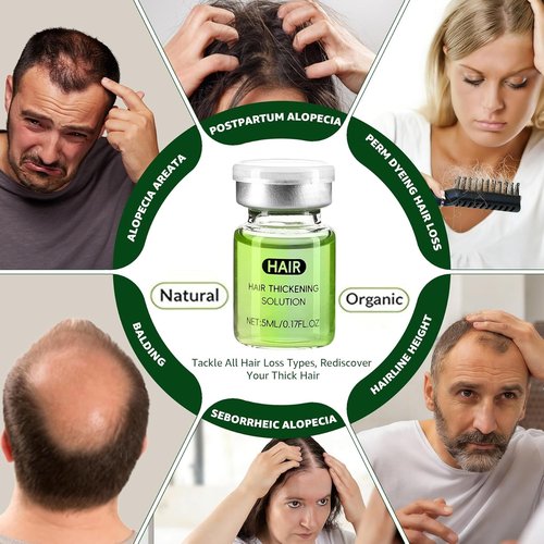 Hair Regrowth System by HairMax - Ginseng & Peppermint Formula | Thicker, Stronger Hair for Men & Women