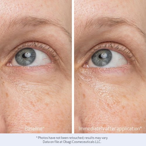Obagi Daily Hydro-Drops Eye Gel Cream - Instantly Brightens & Smooths Dark Circles - 0.5 oz