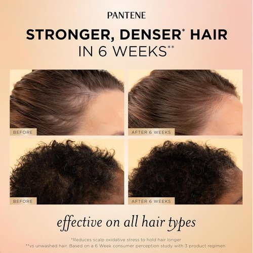 Pantene Abundant & Strong Scalp Serum - Strengthens Roots & Scalp Health | 2 oz