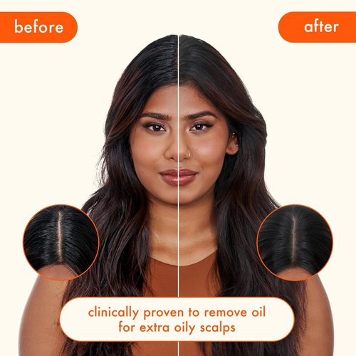 amika perk up ultra oil control dry shampoo | cleans + refreshes scalp + roots, absorbs + helps control oils, extends styles between washes, for all hair types with extra oily scalps