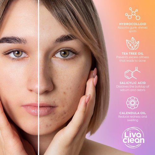 Livaclean 120 CT Pimple Patches for Face w/ Salicylic Acid, Tea Tree & Calendula Oil - Four Sizes Zit Dots Acne Patches for Face - Hydrocolloid Patch Pimple Patch Invisible - Acne Dots Zit Stickers
