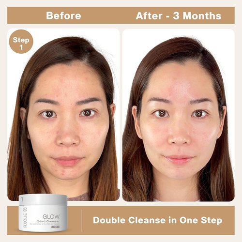 Rxcue Korean Skincare Set - 3-Step K-Beauty Kit for Glass Skin | TSA Approved Travel Size, 1.01 fl oz Each