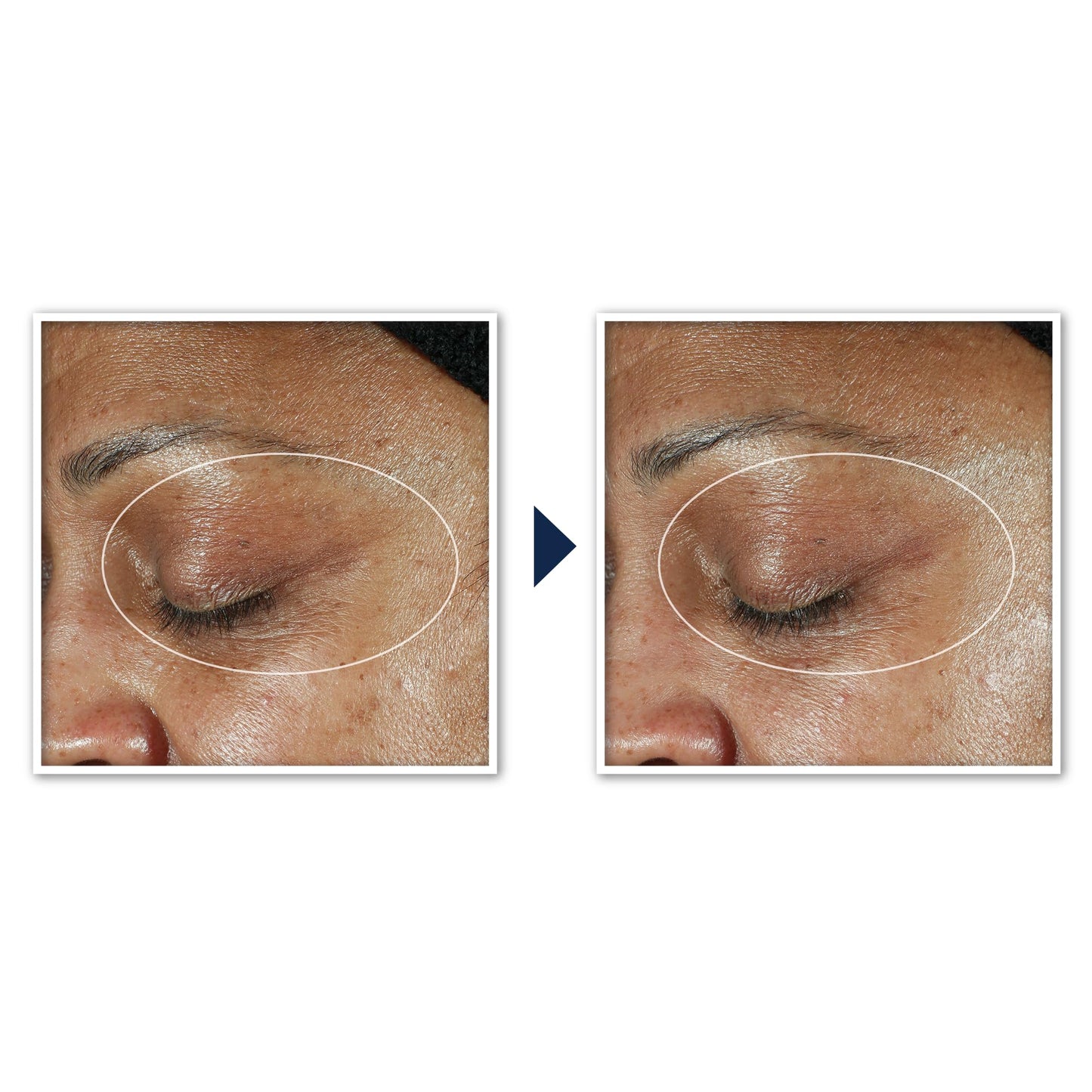 RoC Multi Correxion 5 in 1 Anti-Aging Eye Cream for Puffiness, Under Eye Bags & Dark Circles, Stocking Stuffers for Men & Women, (.5 oz) with Night Cream Packette (Packaging May Vary)