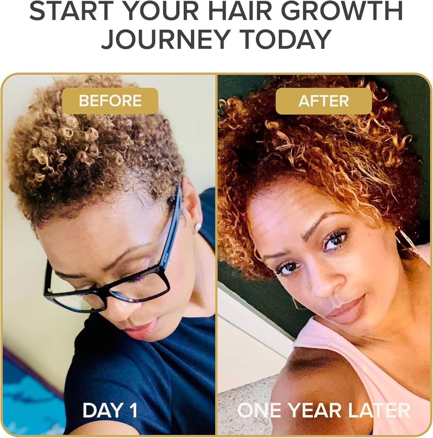 Shedavi Iconic Natural Hair Vitamins - Fast Hair Growth & Thicker, Stronger Hair | Vegan Supplements (60 Capsules)