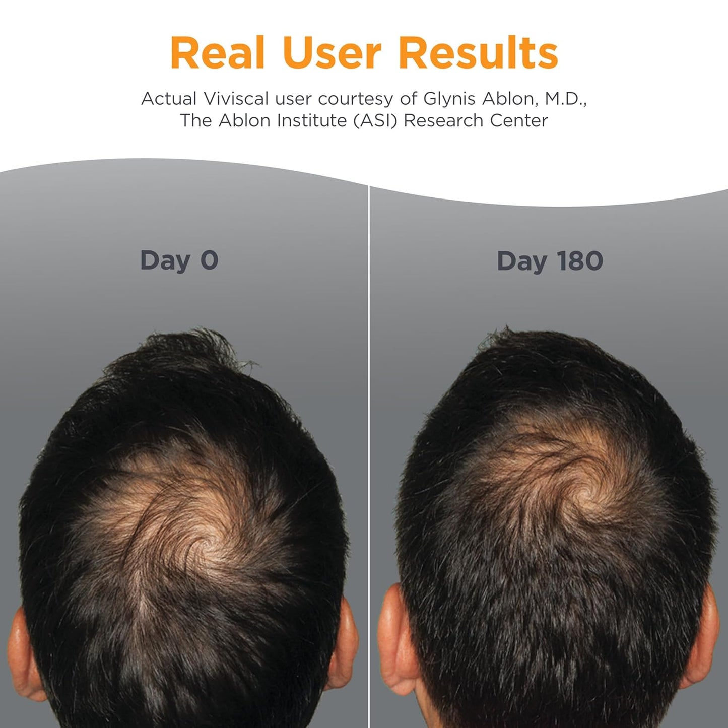 Viviscal Men's Hair Growth Supplements - Clinically Proven Collagen Complex for Thicker, Fuller Hair | 180 Tablets, 3-Month Supply