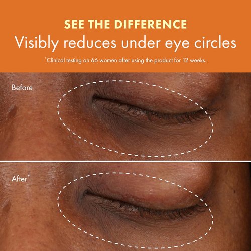 Origins GinZing Brightening Eye Cream - Reduces Dark Circles with Vitamin C & Niacinamide | 0.5 Fl Oz