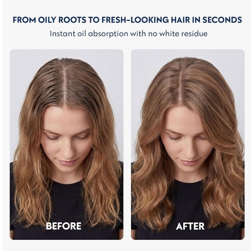 No nothing Volumizing Dry Shampoo - Fragrance Free, Talc-Free, Hypoallergenic, Vegan, Unscented Dry Shampoo for Women and Men, Sensitive Scalp - Absorbs Oil, Clear Finish, 5.3 oz