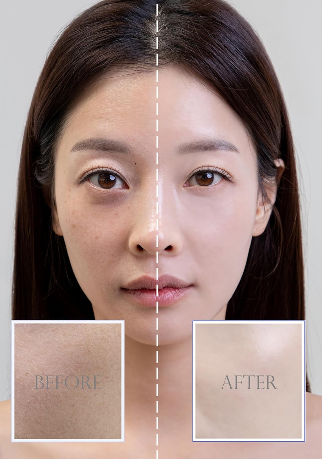 Skiennix Blemish Balm | Korean BB Cream for Dewy Finish & Flawless Coverage | 1.41oz