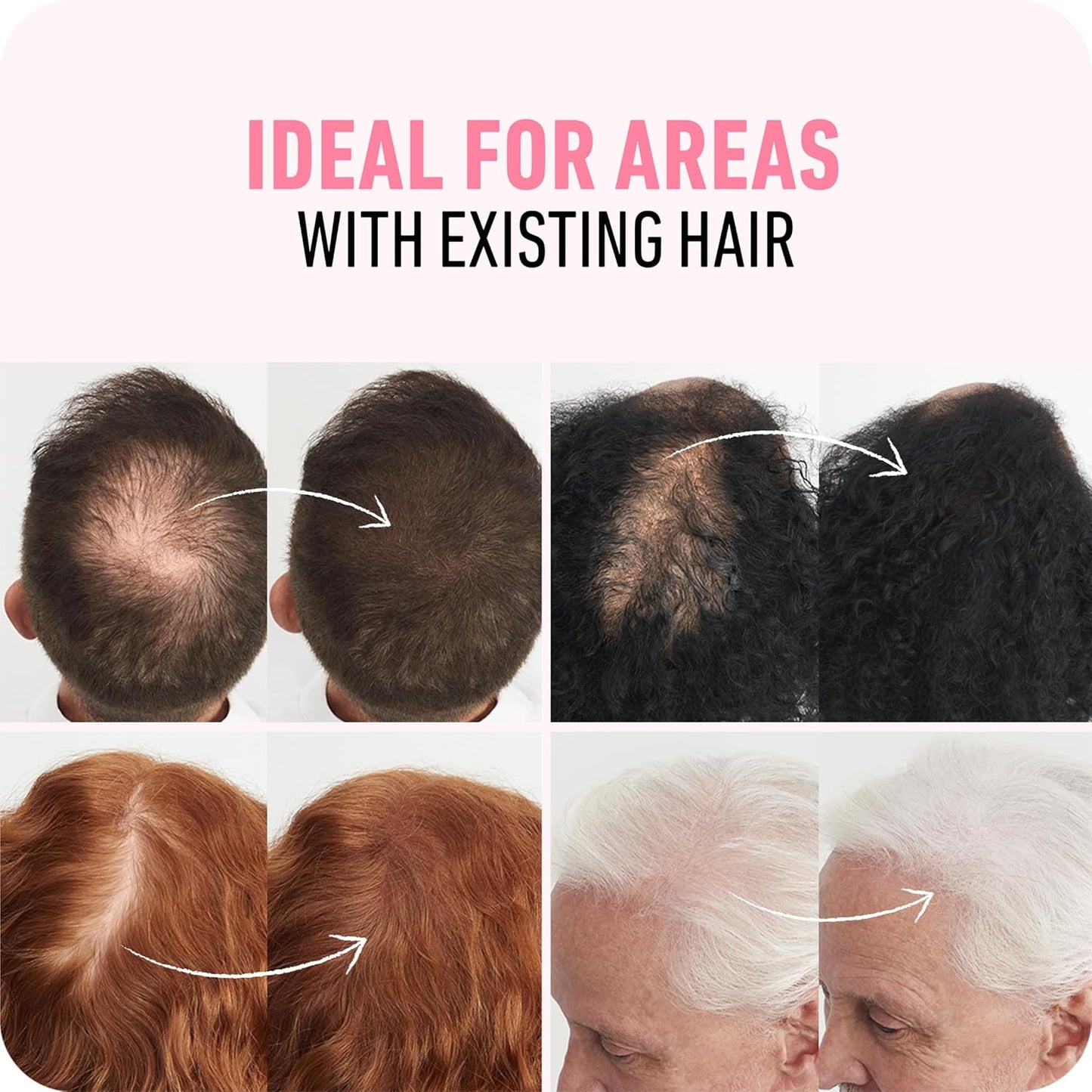 BOLDIFY Hair Fibers - Instantly Thicker & Fuller Hair for Thinning Hair - 12.5g | Light Brown - 14 Shades Available