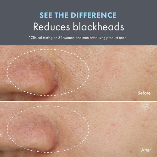 Origins Clear Improvement Face Mask & Scrub - Reduces Blackheads with Salicylic Acid & Bamboo Charcoal, 2.5 Fl Oz