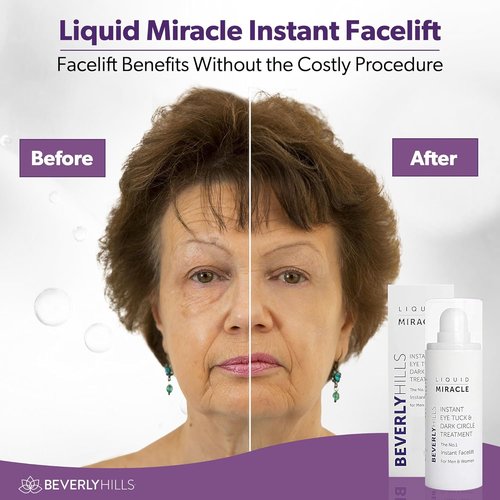 Beverly Hills Instant Facelift Eye Serum - Anti-Aging Treatment for Dark Circles & Puffiness | 30mL (120-Day Supply)