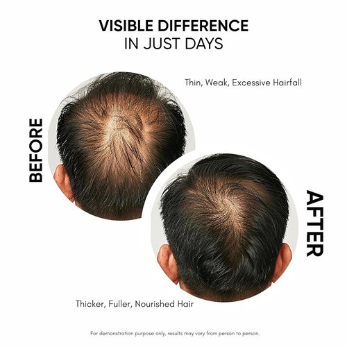Regine Switzerland Hair Growth Serum - Promotes Growth & Reduces Hair Fall | 50 ml for Men & Women