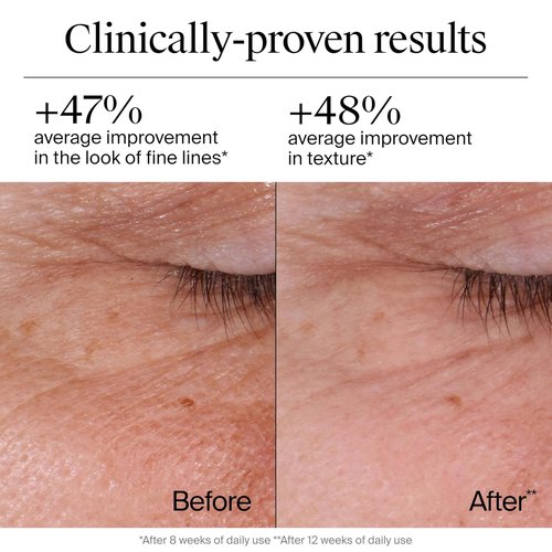 Neutrogena Rapid Wrinkle Repair Face Moisturizer - Anti-Aging Cream with Retinol & Hyaluronic Acid, 1.7 oz | Includes Hydro Boost Cleanser, 0.5 fl. oz