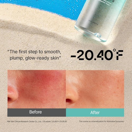 Ectoin Calming Toner by Overlaps - Redness Relief & Barrier Repair for Sensitive Skin | 8.45 fl. oz.