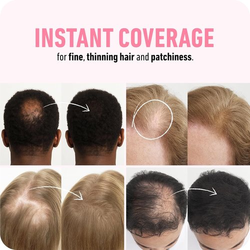 BOLDIFY Hair Fibers - Instantly Thicker Look for Thinning Hair | 28g - Black, 14 Shades Available