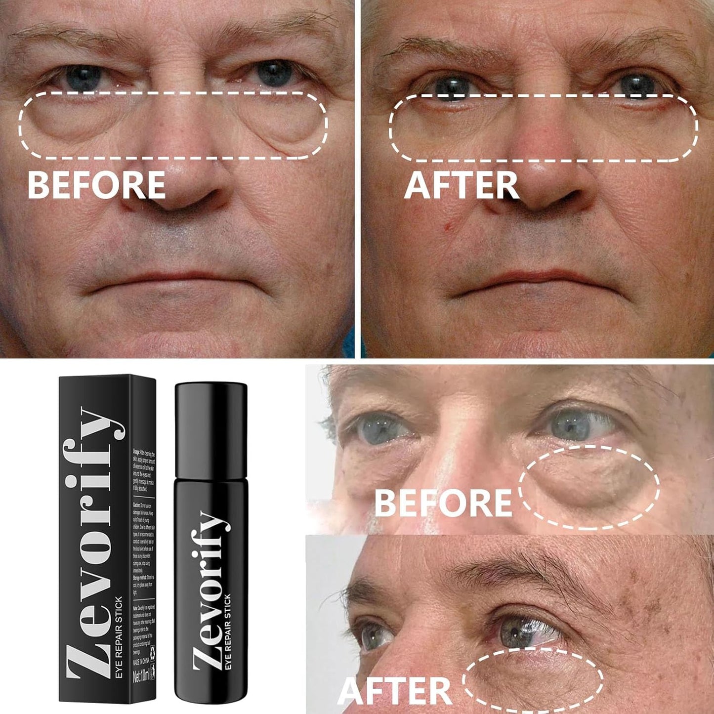 Skiennix Eye Repair Stick - Caffeine Under Eye Roller for Dark Circles & Puffiness | 0.34 Fl Oz