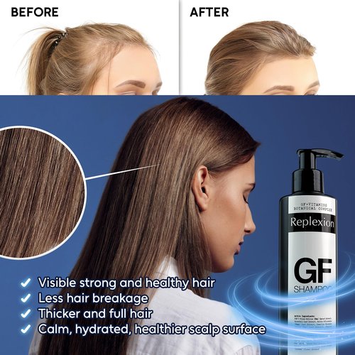 Replexion GF Hair Growth Shampoo for Men & Women – Anti Hair Loss, Hair Thickening, Biotin & Growth Factors – Post Hair Transplant Care, DHT Blocker, Shampoo for Thinning Hair – 3 x 250ml