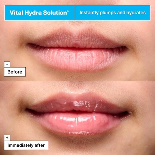 Dr.Jart+ Vital Hydra Solution Jelly Bear Lip Mask - Hydrating Overnight Treatment with Hyaluronic Acid | 0.59 Oz