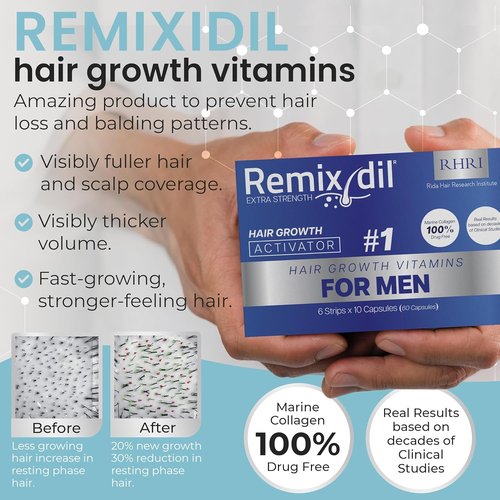 Hair Growth Vitamins - Regrow Hair & Beard | Strengthen Scalp & Reduce Thinning | Fast-Acting 60 Capsules