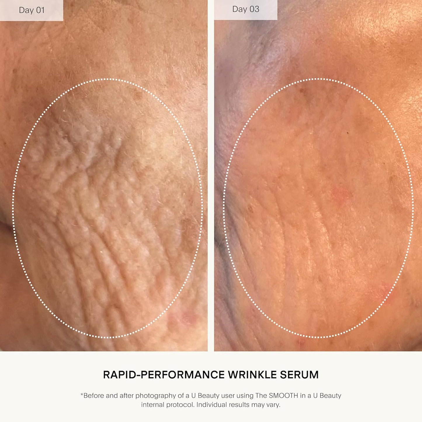 U Beauty The SMOOTH Dynamic Wrinkle Defense Serum - Multi-Peptide Complex & Copper Peptides, 15ml