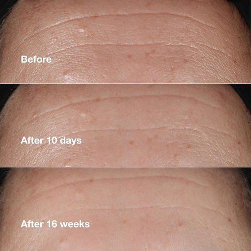 Clinique Smart Clinical Repair Anti-Aging Face Serum - Hydrating Formula with Hyaluronic Acid & Peptides | All Skin Types