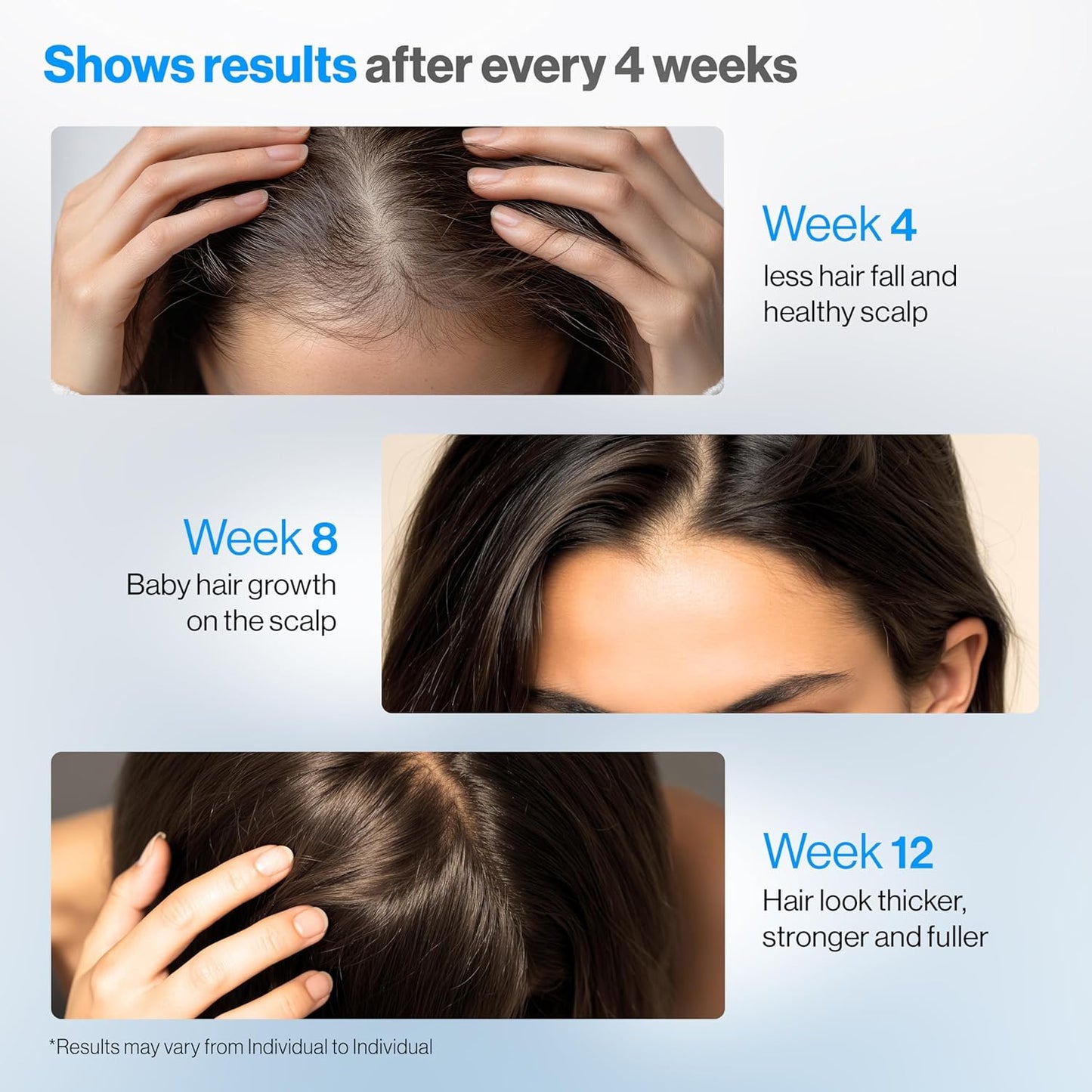 Be Bodywise Hair Growth Serum Roll-On | 5% Saw Palmetto & 3% Rosemary Oil for Effective Hair Regrowth - 25ml/0.84 fl oz