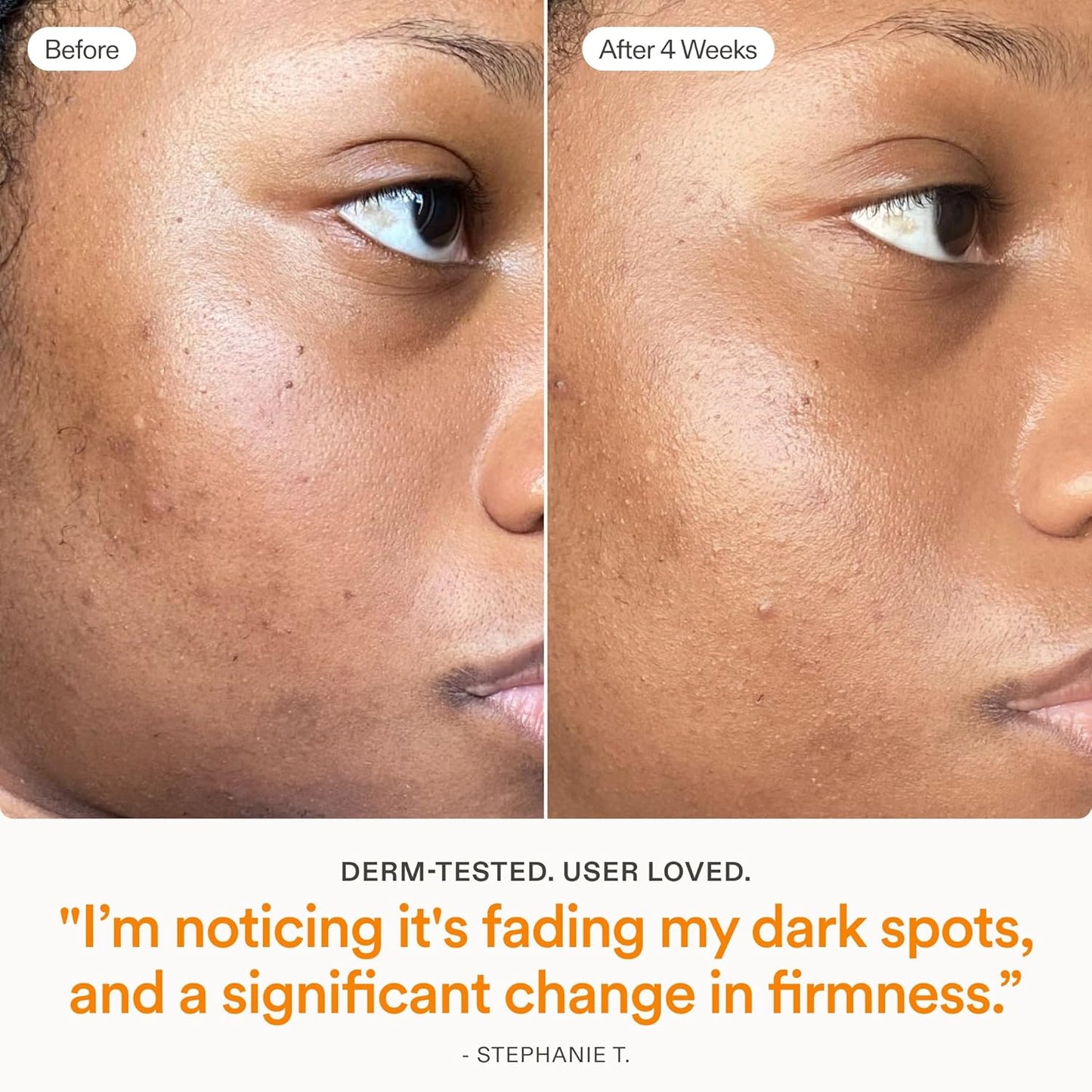 Skinfix Brighten + Firm Vitamin C Serum - 15% Concentration for Dark Spots & Fine Lines - Safe for Sensitive Skin