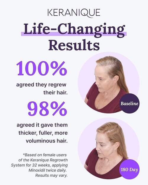 Keranique Hair Regrowth Treatment for Women - 2% Minoxidil Solution for Thicker Hair - 2 Fl Oz with Precision Spray Applicator
