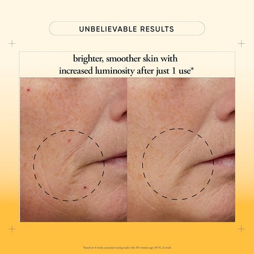 Philosophy Microdelivery Vitamin C Resurfacing Peel Kit - Two-Step Treatment for Smooth Skin & Even Tone