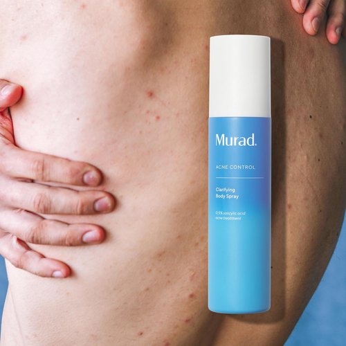 Murad Clarifying Body Spray - Salicylic Acid Treatment for Bacne & Body Acne Prevention | 6.0 oz