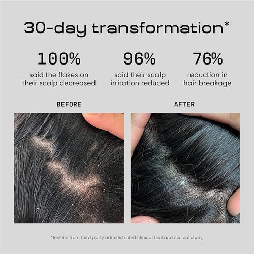 Jupiter Anti-Dandruff Shampoo | Nourishing Formula for Flaky, Itchy Scalp - Color-Safe & Sulfate-Free