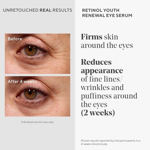 Murad Retinol Youth Renewal Eye Serum - Reduces Dark Circles & Puffiness, Fine Lines | 0.5 oz