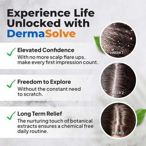 Dermasolve Scalp Oil - Flaky Scalp Relief for Psoriasis & Dandruff - 4 oz, Dermatologist Approved