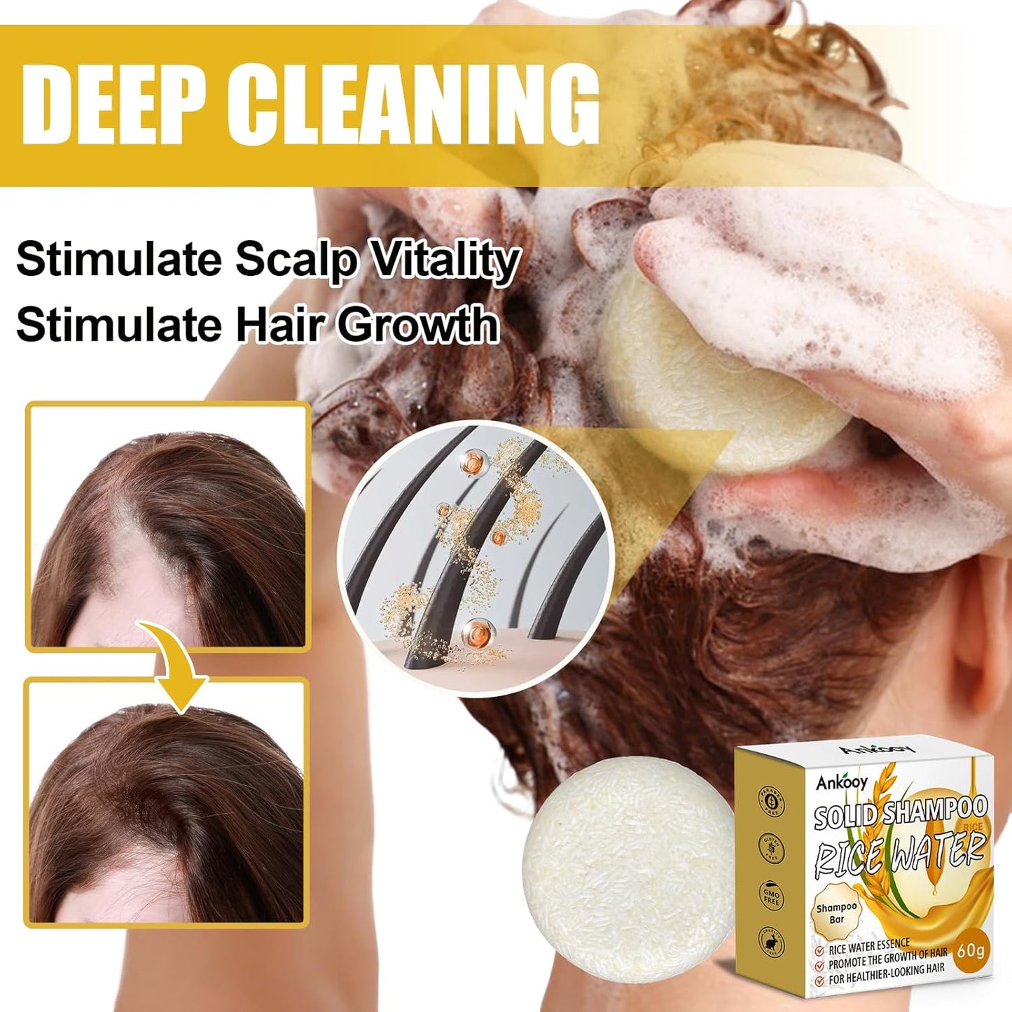 Skiennix Rice Water Shampoo Bar - Deep Cleansing Hair Growth Formula | 2 Pack, Paraben & Sulfate-Free, Vegan