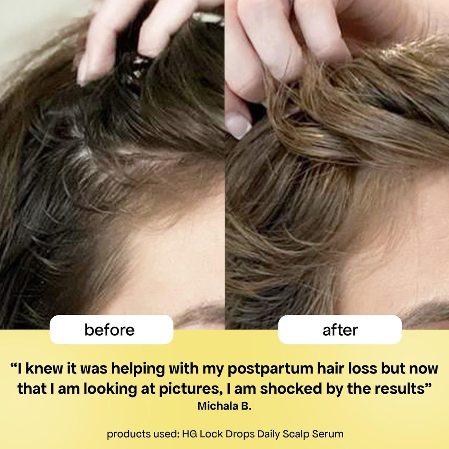 BondiBoost Hair Growth Lock Drops Serum - Non-Greasy Formula for Thicker, Fuller Hair | Vegan & Color-Safe