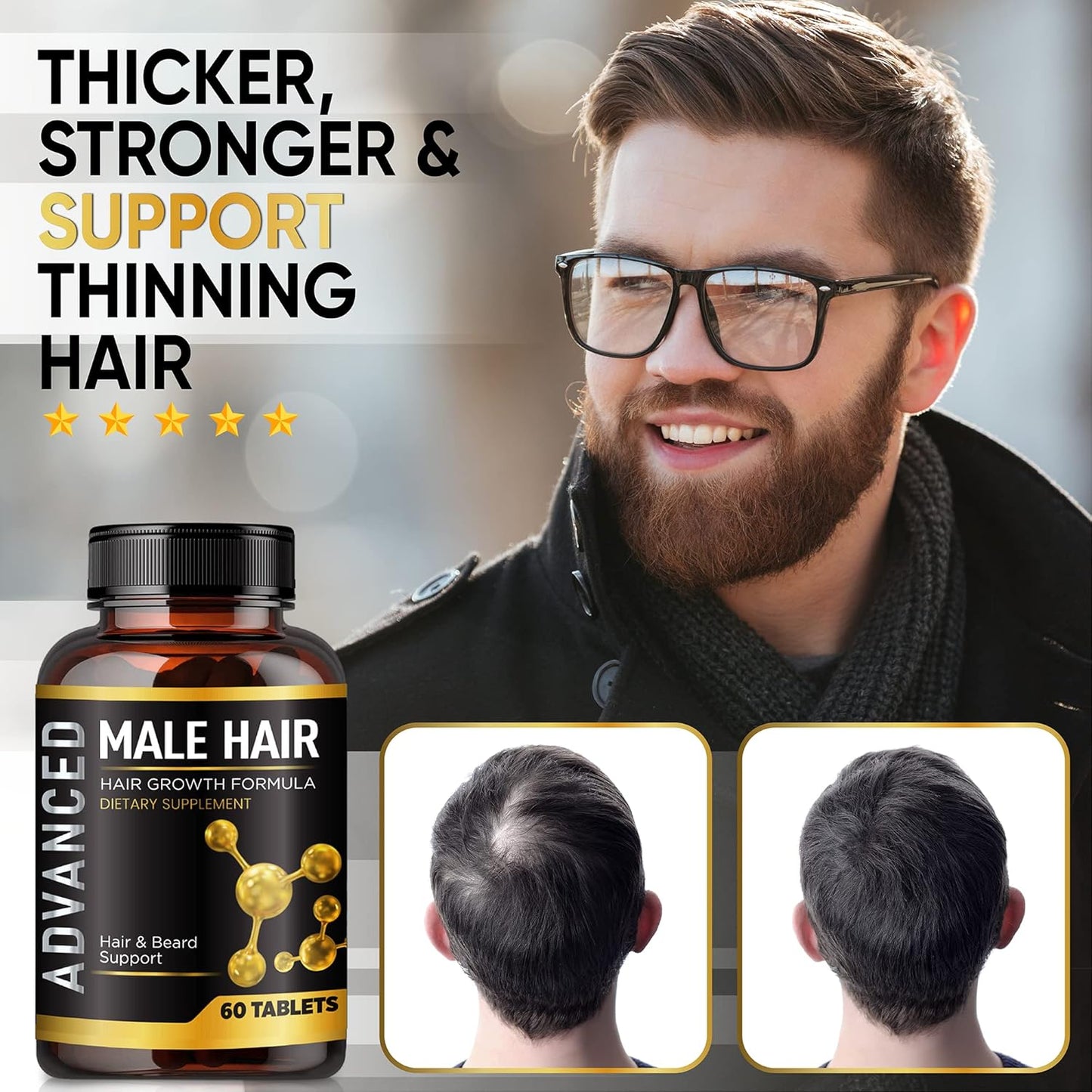 Skiennix Hair Growth Vitamins for Men - DHT Blocker & Biotin Supplement for Thicker, Fuller Hair