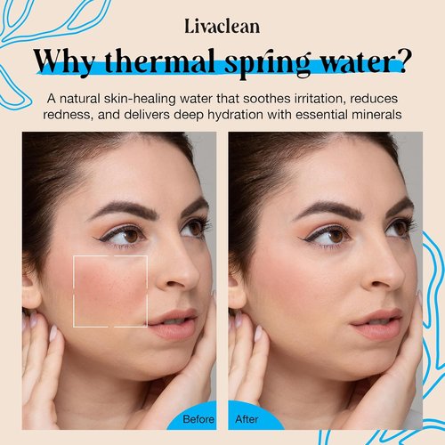 **Thermal Spring Water Face Spray Mist by [Brand Name] - Hydrating & Soothing with Hyaluronic Acid & Aloe Vera | 300ml + 50ml**