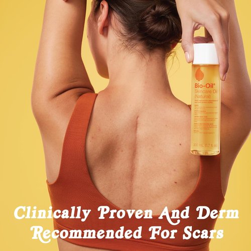 Bio-Oil Natural Skincare Oil - Multi-Purpose Serum for Scars & Stretch Marks | 6.7 Oz
