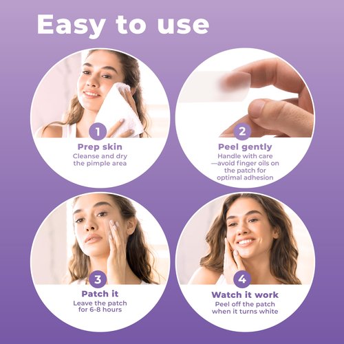 PatchRx Large Pimple Patches for Face (20 Pack), Hydrocolloid Acne Patch, Hydrocolloid Bandages, Big Pimple Patches, Large Acne Patch