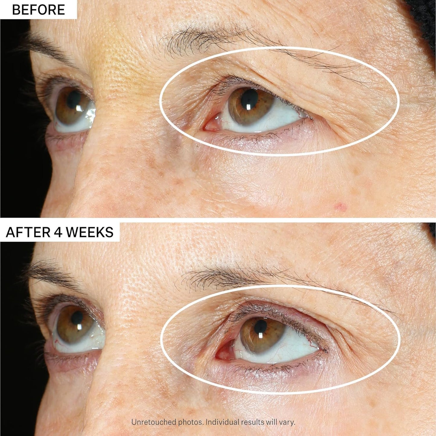 StriVectin Tighten & Lift Peptight 360° Eye Serum & Advanced Neck Cream | Alpha-3 Peptides™