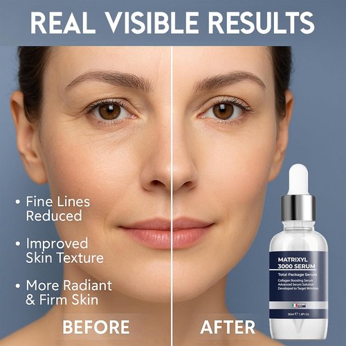 Matrixyl 3000 Serum - Anti-Aging & Hydrating Formula with Hyaluronic Acid | 30ml Deep Wrinkle Repair
