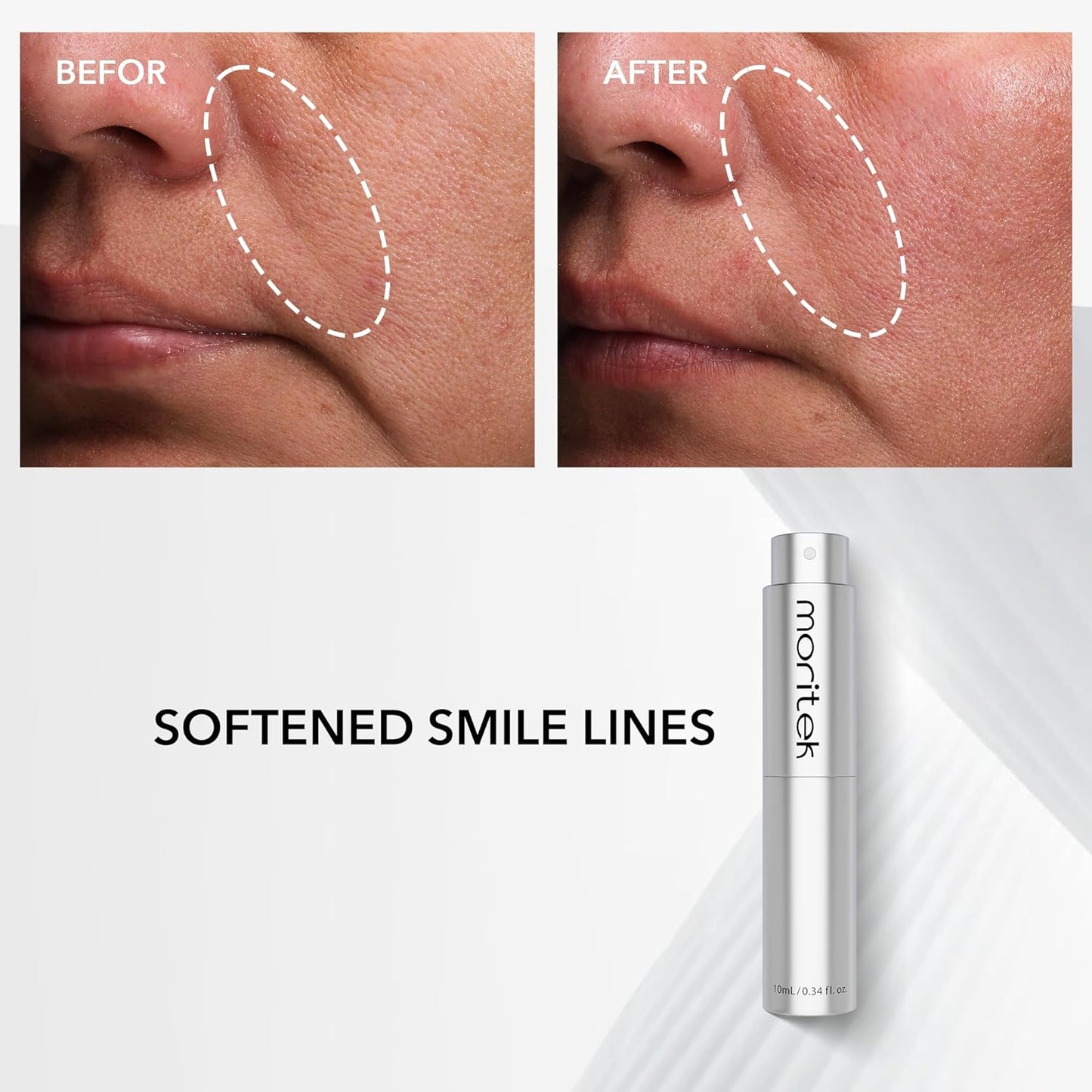 Skiennix Anti-Wrinkle Essence Mist - Firm, Hydrate & Brighten Sensitive Skin | 10ml