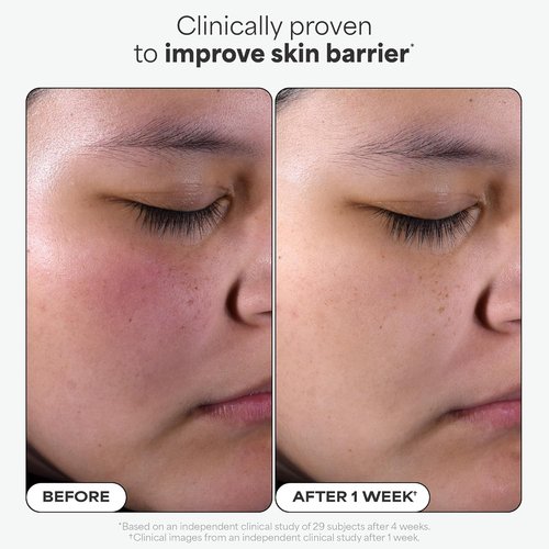 Paula's Choice Skin Perfecting 2% BHA Liquid Exfoliant - Salicylic Acid Facial Polish for Pores & Fine Lines