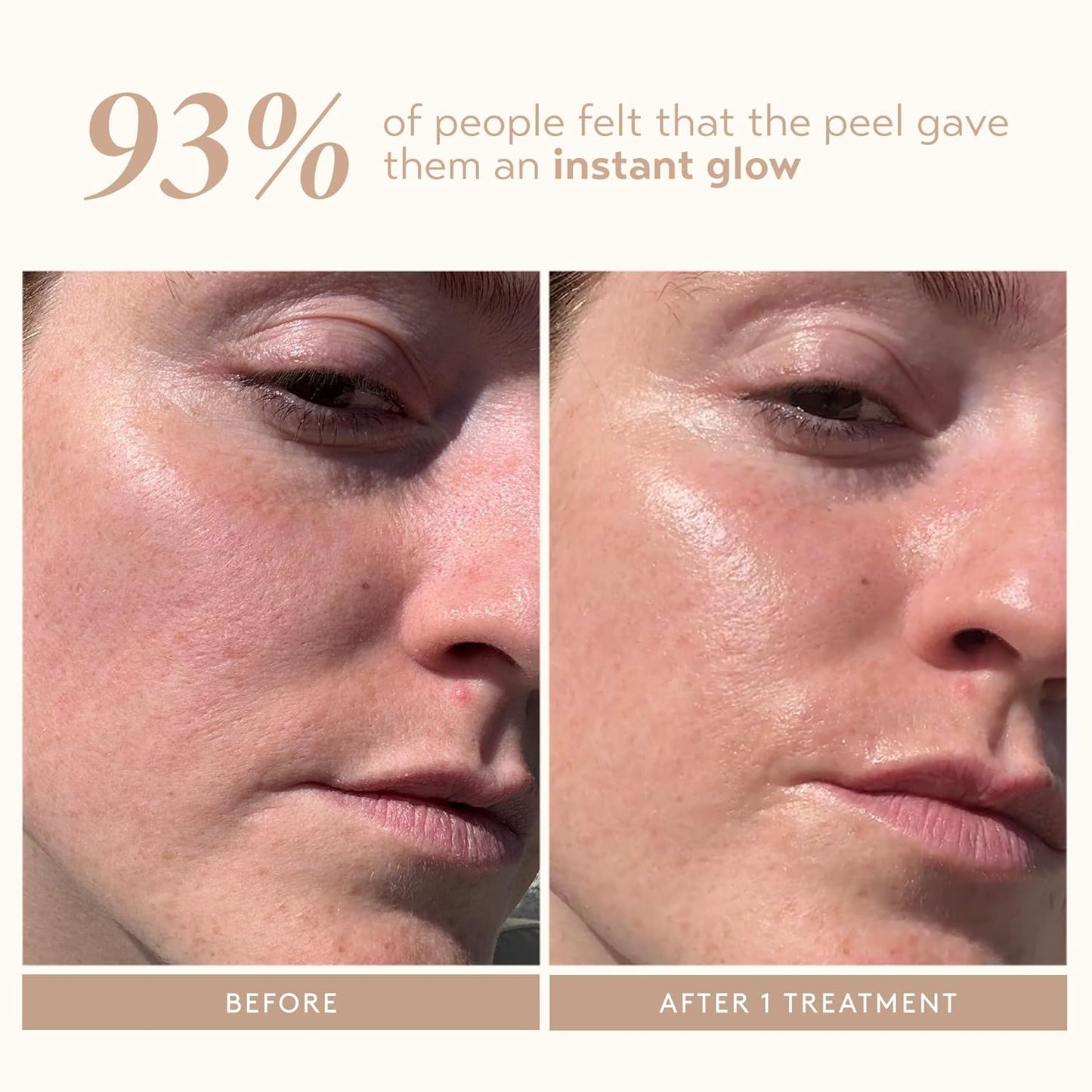 SHANI DARDEN SKIN CARE Triple Acid Peel - 2-Step Exfoliating Treatment with Mandelic, Lactic & Glycolic Acids | Includes Neutralizing Mask & Brush (0.5 fl oz)