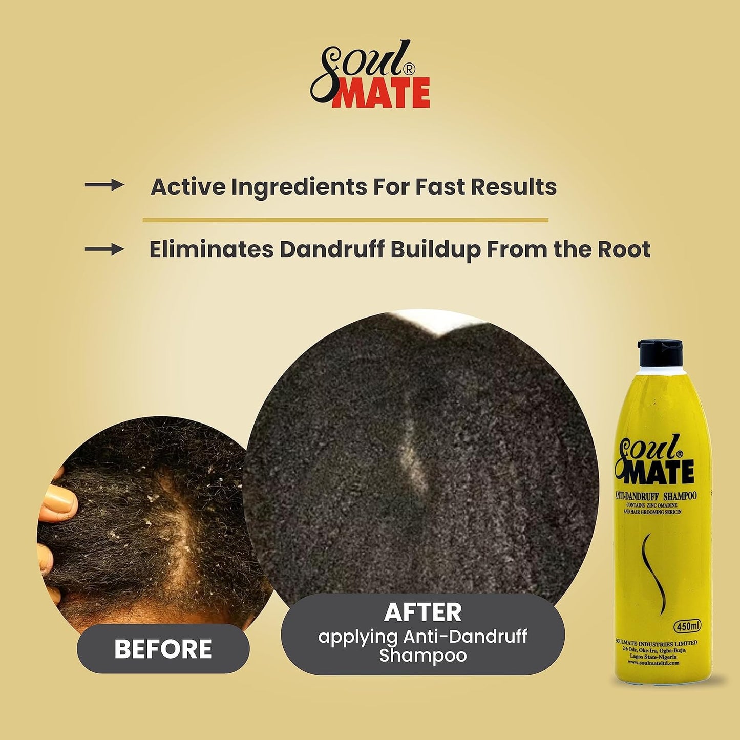 SOUL MATE Anti-Dandruff Shampoo - Sericin Formula for Itchy Scalp Relief | 15.2oz Residue-Free Treatment