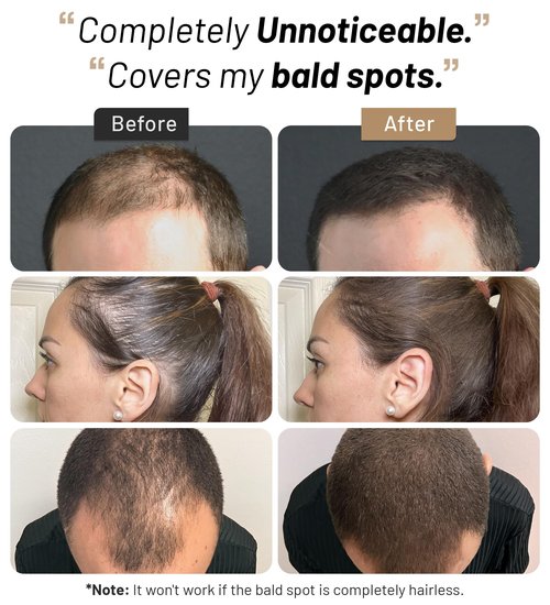 CONFIERR Hair Fibers for Men & Women (30 Grams, White), Fill In Fine or Thinning Hair, Instantly Thicker, Fuller Looking Hair