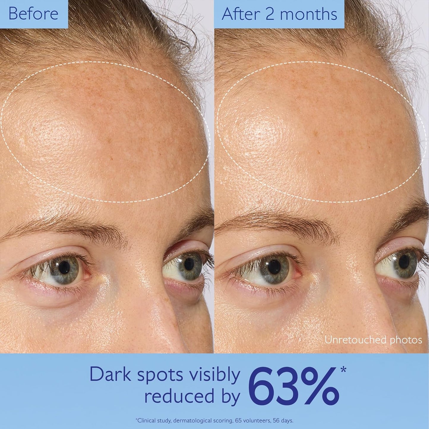 Caudalie Vinoperfect Brightening Dark Spot Serum | 62x More Effective Than Vitamin C for Even Skin Tone